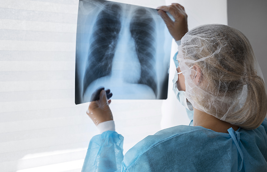 X-Ray cover photo