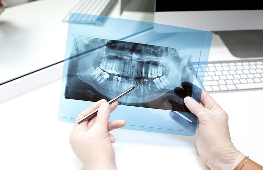 OPG & CBCT cover photo
