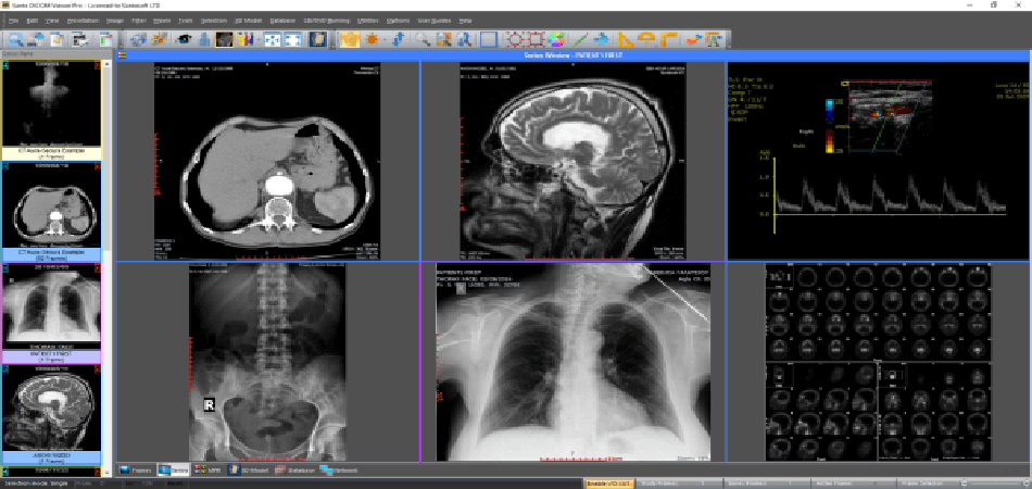 Universal X-Ray Imaging Dicom Software